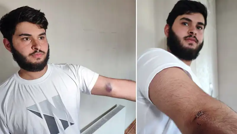 Bahçeye Kaçan Top Mahallede Şok Etkisi Yarattı: Conoların Gelmesi Ne Anlama Geliyor?