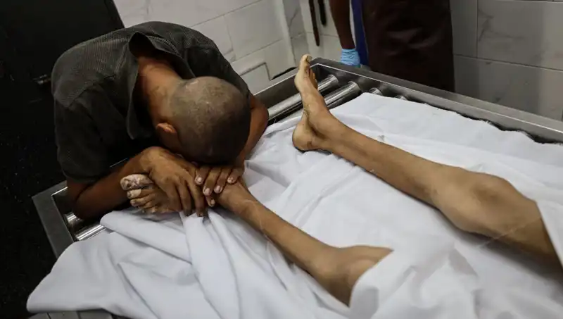 Gazze’de Açlık Sınırında Hayat Mücadelesi: Bir Çocuk Daha Hayatını Kaybetti